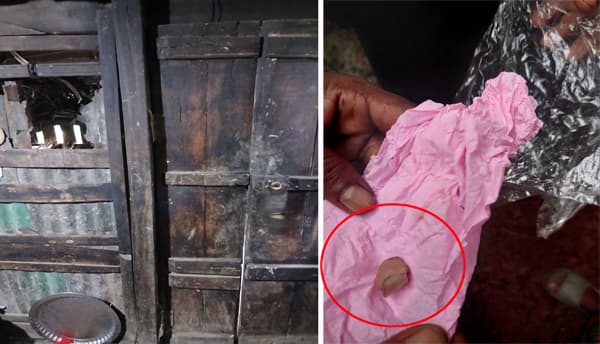 রাজাপুরে চোর প্রতিরোধে গৃহবধূর কামড়ে বিচ্ছিন্ন হলো চোরের আঙুল