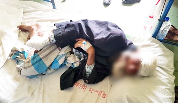 শরীয়তপুরে দুধ বিক্রি নিয়ে দ্বন্দ্ব, একই পরিবারের পাঁচজনকে কুপিয়ে জখম