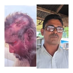 সিরাজগঞ্জে জমি নিয়ে বিরোধ, নিজের মাথা কেটে মামলার নাটক