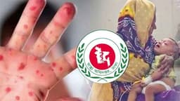 দেশে হামে ভয়াবহ শিশু মৃত্যু ইতিহাসে নজিরবিহীন সংকট