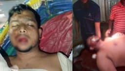 সন্ত্রাসী হামলার শিকার রূপনগর থানা যুবদলের সাবেক দপ্তর সম্পাদক শাহীনুজ্জামান 