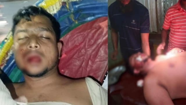 সন্ত্রাসী হামলার শিকার রূপনগর থানা যুবদলের সাবেক দপ্তর সম্পাদক শাহীনুজ্জামান 