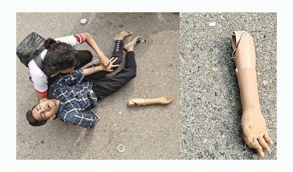 লাঠিচার্জের ভেতর পড়ে রইল জুলাই যোদ্ধার হাত!