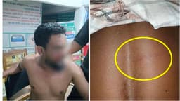 তেল বিক্রি নিয়ে উত্তেজনা: পানছড়িতে সংঘর্ষ, আহত ৩