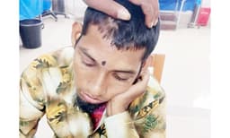 নবাবগঞ্জে শারীরিক প্রতিবন্ধী যুবক এনথ্রাক্স রোগে আক্রান্ত