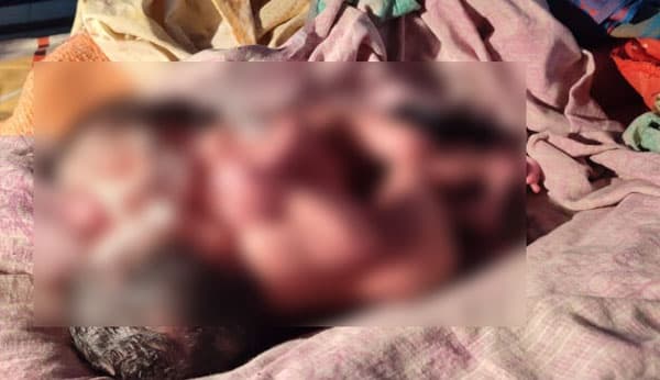 ধামইরহাটে আলোচিত সেই জমজ শিশুদের মৃত্যু