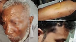 পদ্মা নদীতে নৌ পুলিশের ওপর হামলা, ওসিসহ পাঁচ সদস্য গুলিবিদ্ধ