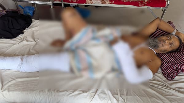 চাঁদা না দেওয়ায় ইউপি সদস্যের হাত-পা ভেঙে দিল যুবদল নেতাকর্মীরা!