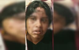পারিবারিক বিরোধে চাচির মুখে ফুটন্ত গরম পানি ঢাললেন ভাতিজার বউ
