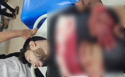 চাঁদা না দেওয়ায় নোয়াখালীতে প্রবাসীর কবজি কেটে দিল সন্ত্রাসীরা