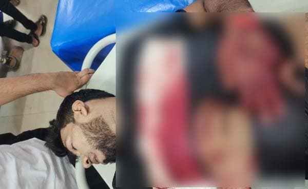চাঁদা না দেওয়ায় নোয়াখালীতে প্রবাসীর কবজি কেটে দিল সন্ত্রাসীরা