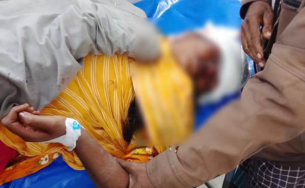 নবাবগঞ্জে কিশোরীর শয়ন ঘরে ঢুকে মাথায় ছুরিকাঘাতের অভিযোগ