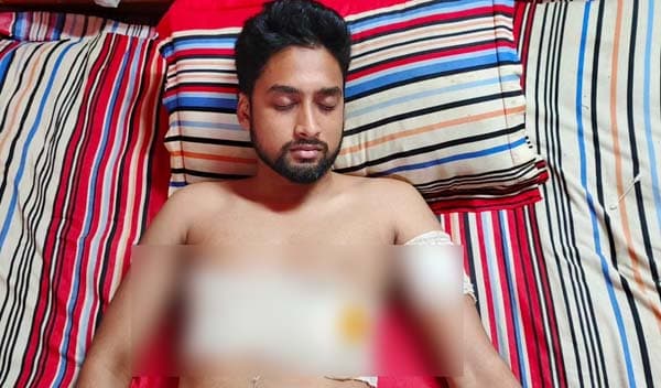 মাদক ব্যবসায় বাধা দেওয়ায় পিরোজপুরে কলেজছাত্রকে কুপিয়ে আহত