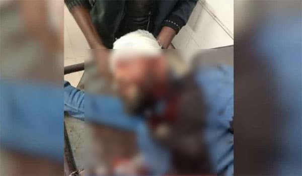 খুলনায় এনসিপি নেতা মোতালেব শিকদার গুলিবিদ্ধ