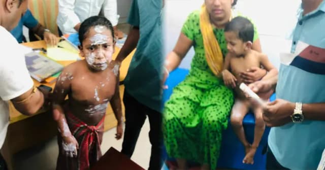 নোয়াখালীতে গ্যাস লিকেজে বিস্ফোরণ, দগ্ধ একই পরিবারের ৪ জন