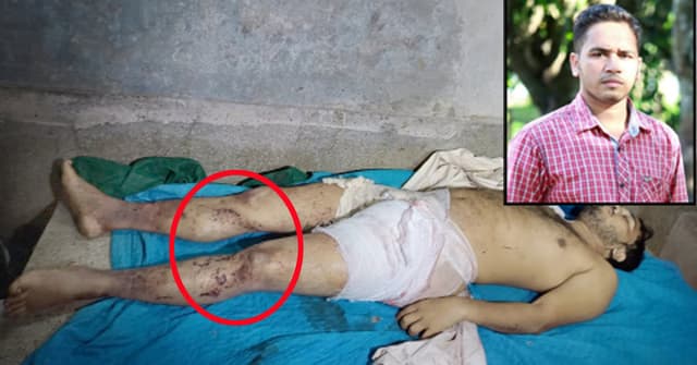 বরিশালে ডিবি পুলিশের নির্যাতনে যুবকের মৃত্যুর অভিযোগ