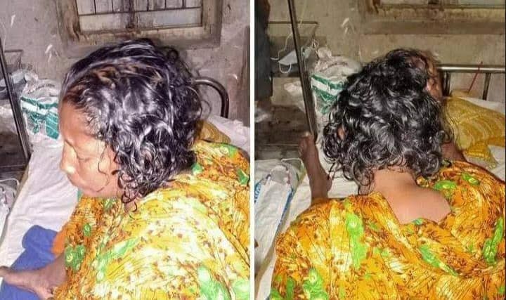 শ্যামনগরে মহিলাকে মারপিট করে মাথার চুল কেটে নেওয়ার অভিযোগ