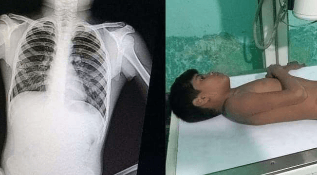 মেহেরপুরে তুচ্ছ ঘটনাকে কেন্দ্র করে ৫ম শ্রেণীর ছাত্রকে নির্যাতন