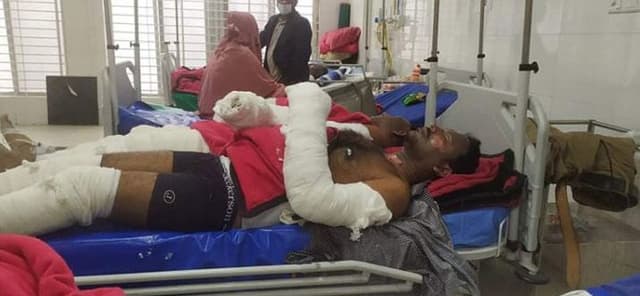 রাজধানীতে গাড়ির ওয়ার্কশপে কাজ করার সময় আগুনে ৭ জন দগ্ধ