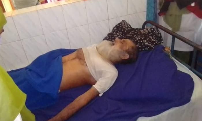 পাথরঘাটায় গাছ থেকে পড়ে বৃদ্ধের মৃত্যু