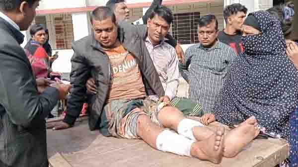 কালকিনিতে মামলার জেরে ব্যবসায়ীকে হাতুড়ি পেটা !