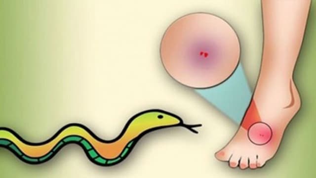 হিজলায় সাপের কামড়ে আহত ইউএনও এর কন্যা