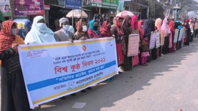 ঝিনাইদহে বিশ্ব কুষ্ঠ দিবস পালিত