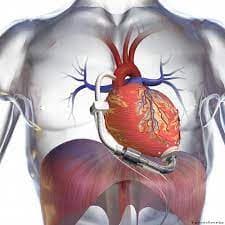 মরণোত্তর দেহদান সম্পর্কে ইসলামের নির্দেশনা
