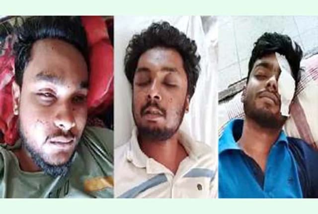 দৃষ্টি হারানোর পথে রাবির সেই তিন শিক্ষার্থী