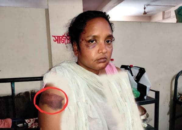 যৌতুকলোভী স্বামীর নির্যাতনে অজ্ঞান স্ত্রীকে উদ্ধার