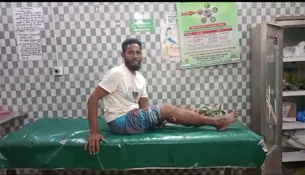 শুকরের কামড়ে নারীসহ জখম ৩