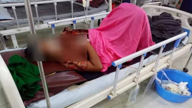 সিজারের ৫ মাস পর পেট থেকে বের হলো ‘গজ’