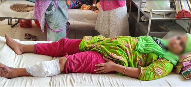 ঘুমন্ত বেদে পল্লীতে নারকীয় হামলা!