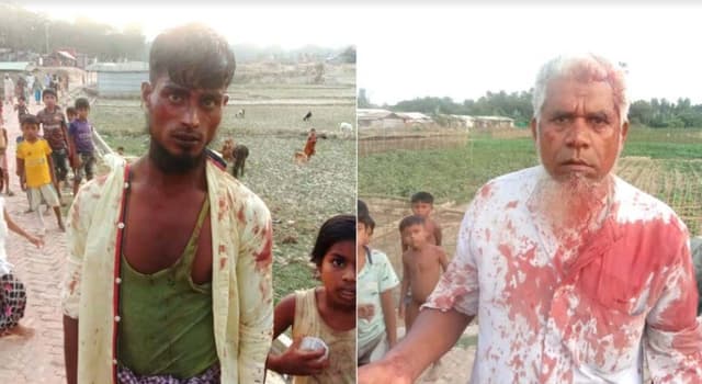 টেকনাফে রোহিঙ্গা ক্যাম্পে রক্তাক্ত জামাই-শ্বাশুড়