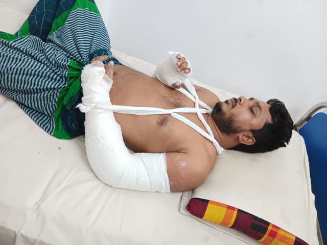 ইভটিজিংয়ের প্রতিবাদ করায় শিক্ষকের দুই হাত ভেঙ্গে দিল কিশোর গ্যাং