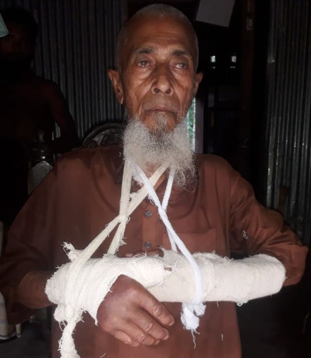 ভরণপোষন চাওয়ায় বাবার হাত ভেঙ্গে দিলো কুলাংগার ছেলে