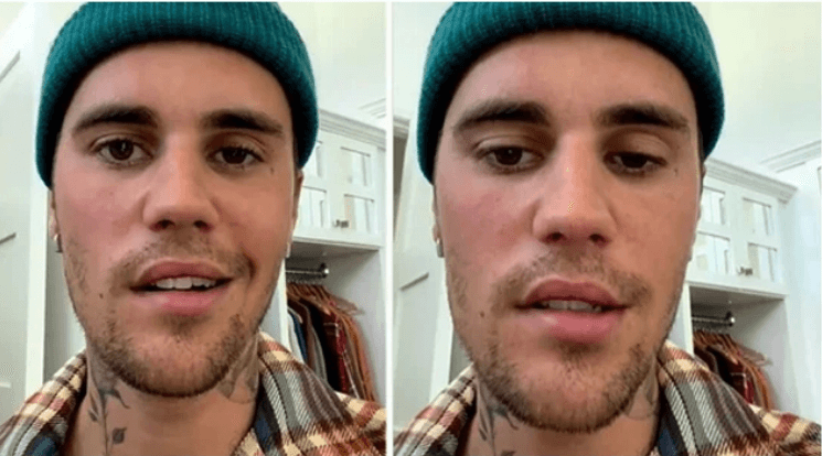 বিরল রোগে আক্রান্ত জাস্টিন বিবার, পারছেন না ঠিকমতো কথা বলতে