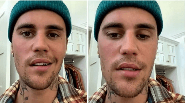 বিরল রোগে আক্রান্ত জাস্টিন বিবার, পারছেন না ঠিকমতো কথা বলতে