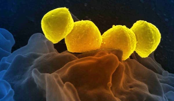 জাপানে ছড়িয়ে পড়ছে ব্যাকটেরিয়া 'গাস', আক্রান্ত হলেই ৪৮ ঘণ্টায় মৃত্যু!