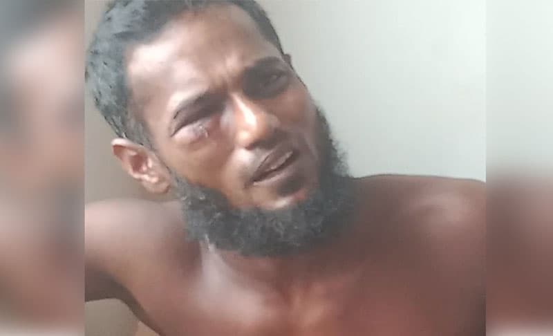 চুরির অভিযোগ তুলে পুড়িয়ে দিলো যুবকের গোপনাঙ্গ