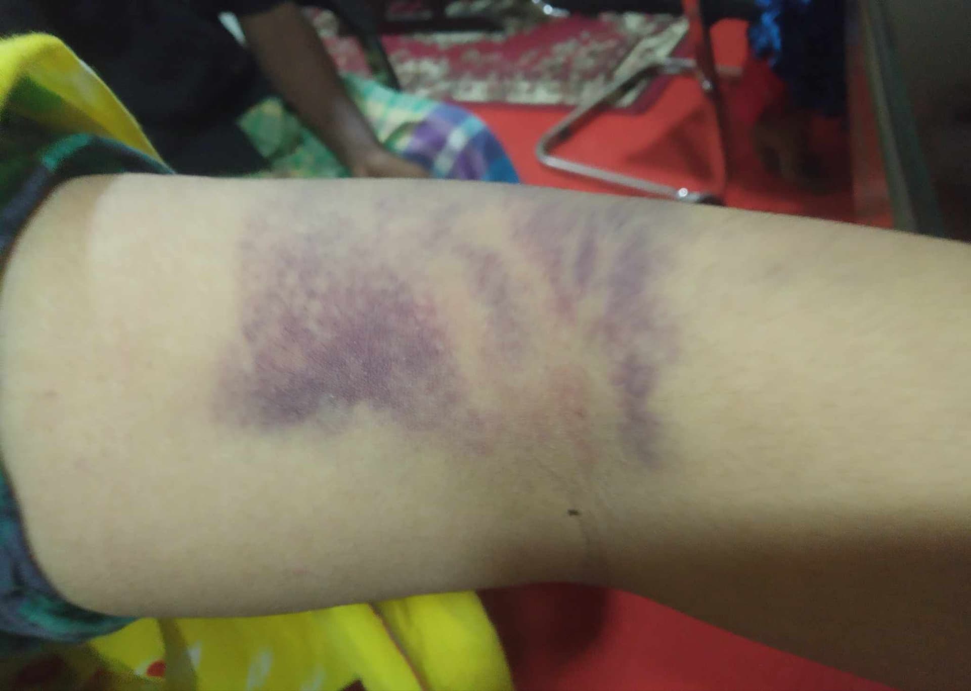 চাউল পড়া খাইয়ে চোর সাব্যস্ত, গৃহকর্মী ও তার স্বামীকে মারধরের অভিযোগ