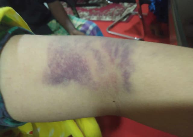 চাউল পড়া খাইয়ে চোর সাব্যস্ত, গৃহকর্মী ও তার স্বামীকে মারধরের অভিযোগ