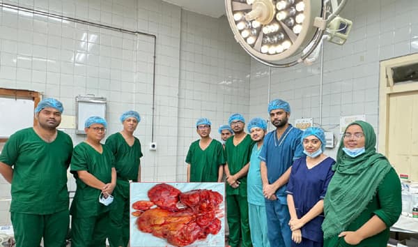 ৫০ কেজি ওজনের রোগীর পেট থেকে ১২ কেজি ওজনের টিউমার অপসারণ