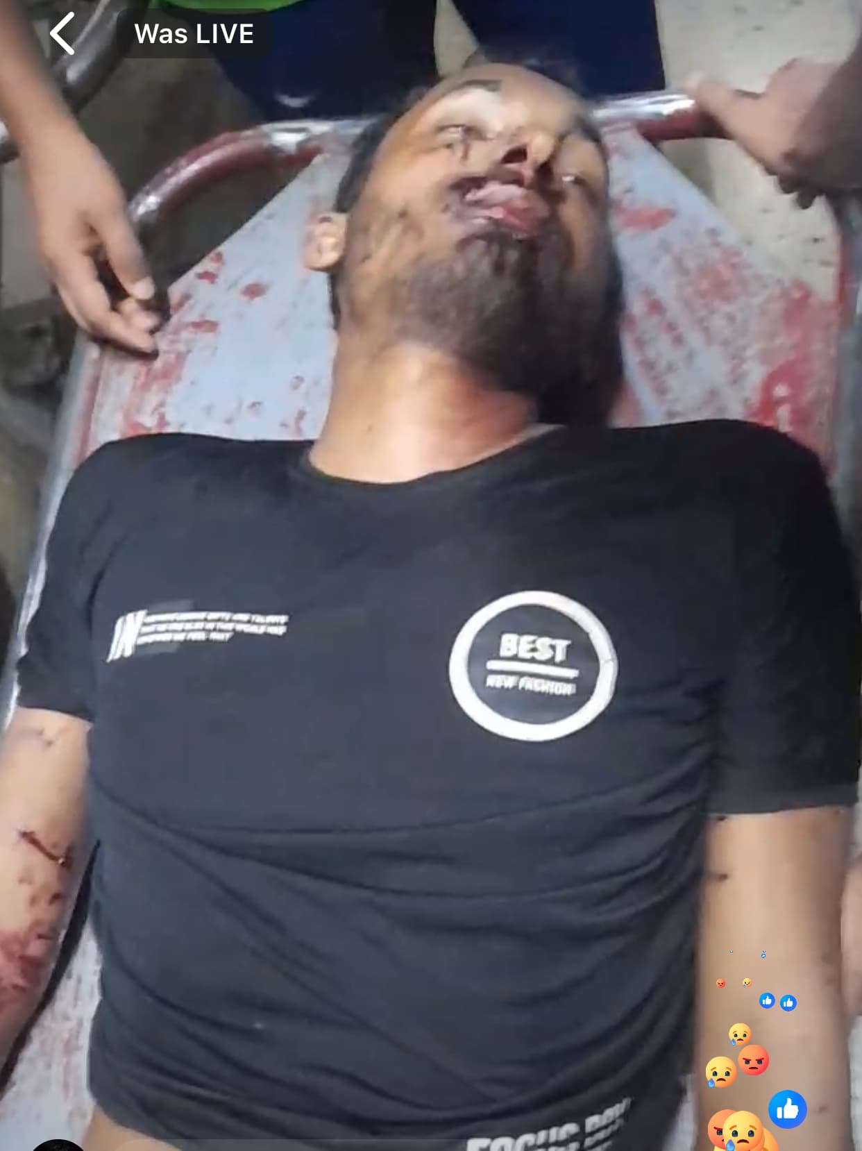 রংপুরে কোটা  আন্দোলনকারী পারভেজ নামক এক শিক্ষার্থী নিহত