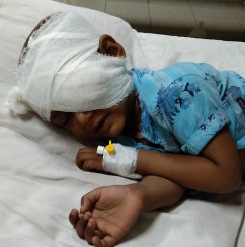 চোখে ক্যান্সারে আক্রান্ত আলিফ বাঁচতে চায়