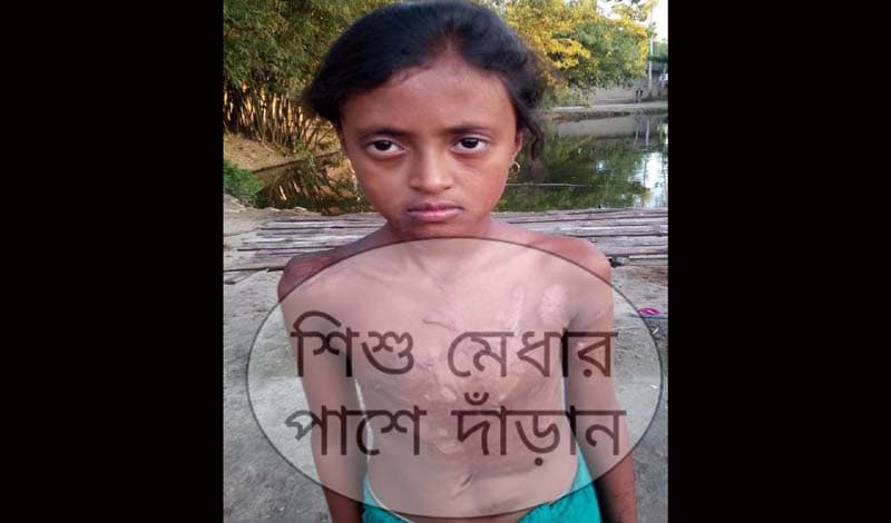 হিলিতে অর্থের অভাবে তৃতীয় শ্রেণির শিক্ষার্থীর উন্নত চিকিৎসা বন্ধ
