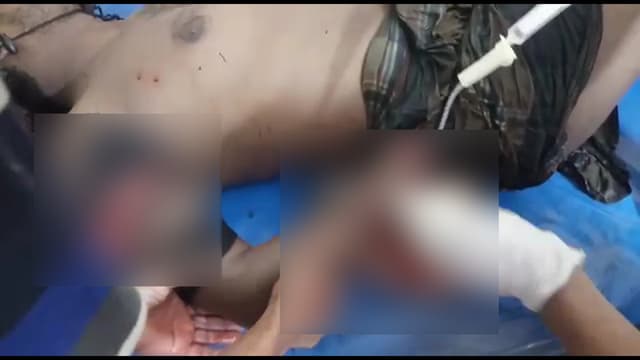 ছাত্রলীগের যুগ্ম সম্পাদকের হাতের কব্জি কর্তন