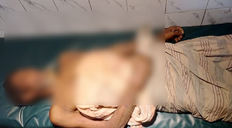 ভাগ্নের ধাক্কায় বুকে রড ঢুকে মামার মৃত্যু