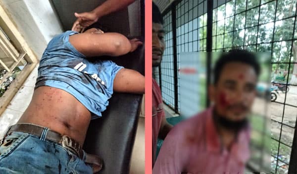 শ্রীমঙ্গলে বিজয় মিছিলে গুলিতে আহত শতাধিক ছাত্রজনতা