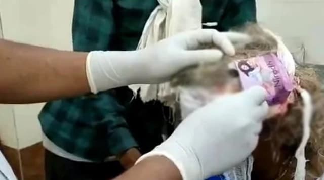 কনডোমের প্যাকেট দিয়ে ক্ষতস্থানে ব্যান্ডেজ! আজব কাণ্ড স্বাস্থ্যকেন্দ্রে